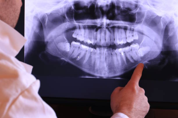Best Emergency Gum Treatment in Chattanooga, TN